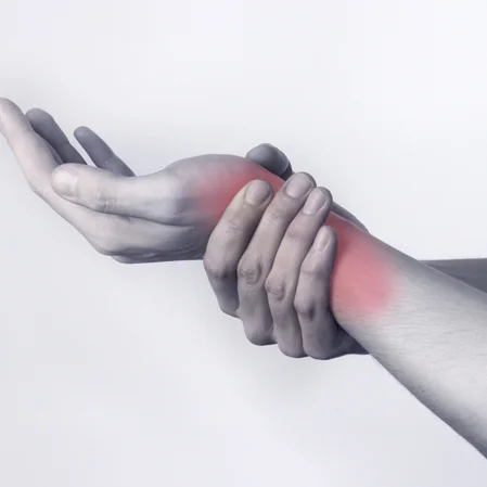 A patient holding their wrist with pain indicated in red