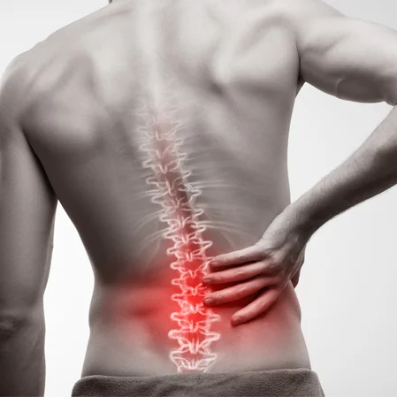 Low back pain indicated with red highlighting on a patient's back